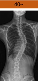 コブ角 40度以上