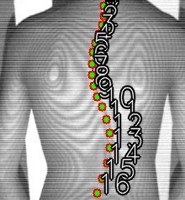 椎体位置推定プログラム（SaMD）