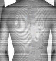 非侵襲3Dスキャナ